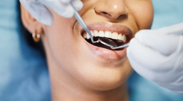 Best Emergency Root Canal Treatment in Bolingbrook, IL